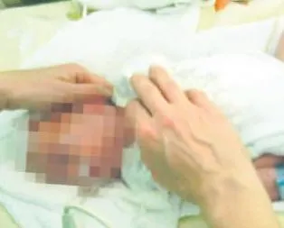 10 aylık bebeğe darp