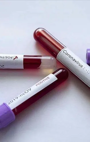 Koronavirüste son durum: 1.491 yeni vaka var