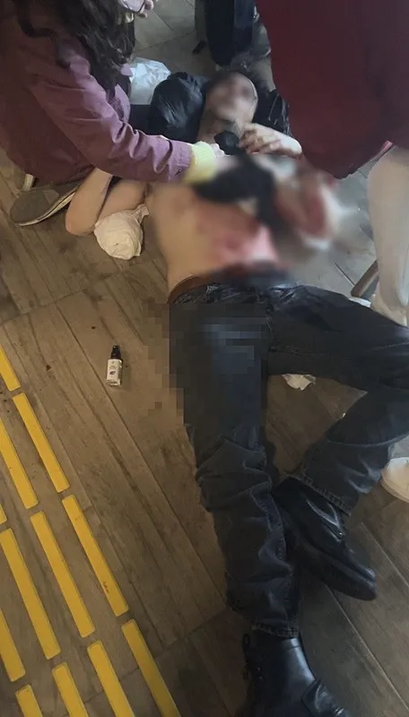 ozel-universitede-donem-odevi-kavgasi-gogsune-3-bicak-1772105007671.jpeg Özel üniversitede 'dönem ödevi' kavgası: Göğsüne 3 bıçak!-2