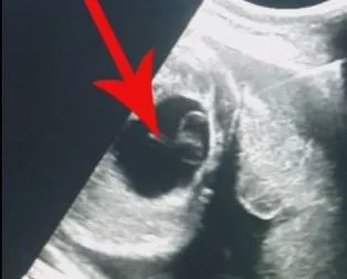 Böyle ameliyat görülmedi!