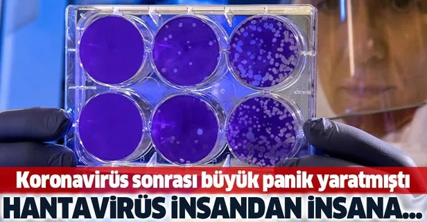 Koronavirüs salgını sonrası panik yaratmıştı! Hantavirüs insandan insana...
