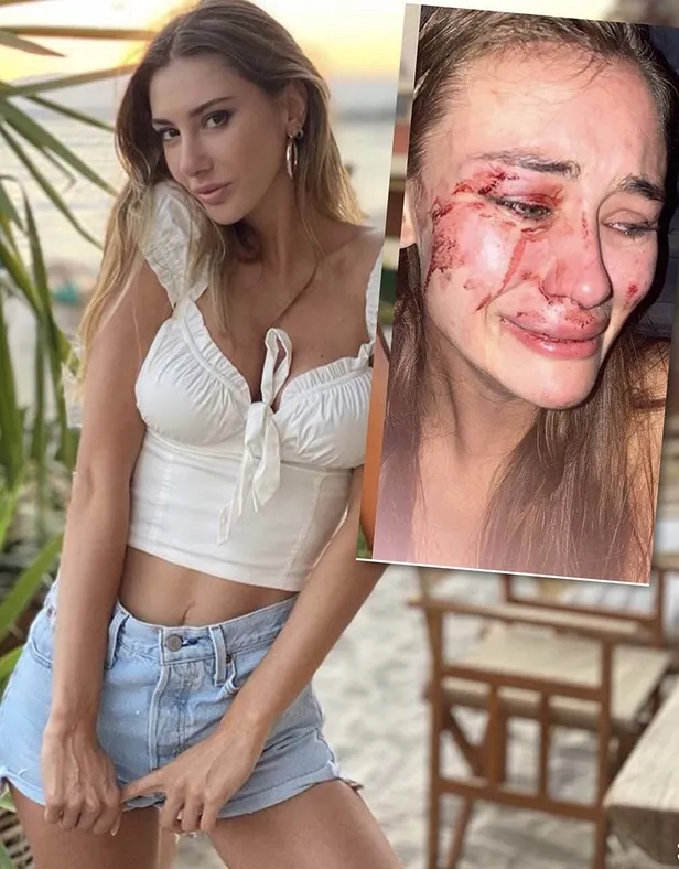 Ukraynalı model Daria Kyryliuk'un dövüldüğü iddiasıyla gündeme gelen 'The Beach of Momo' kapatıldı!-2