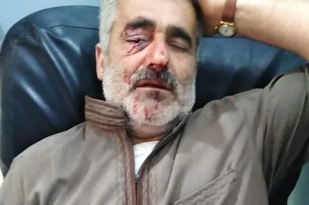 Son dakika: Afrin'e saldırı: 2 ölü, 1 yaralı