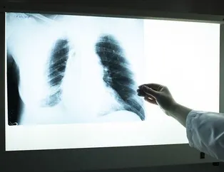 Hırıltılı nefes KOAH demek