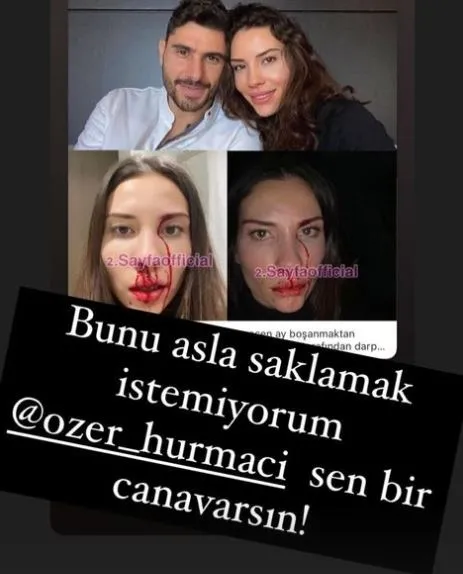 bosanmaktan-vazgecmislerdi-mihriban-hurmaci-sen-bir-canavarsin-ozer-hurmaci-dedi-kanlar-icinde-paylasti-1643995088175.jpg Boşanmaktan vazgeçmişlerdi! Mihriban Hurmacı ‘Sen bir canavarsın Özer Hurmacı’ dedi kanlar içinde paylaştı-7
