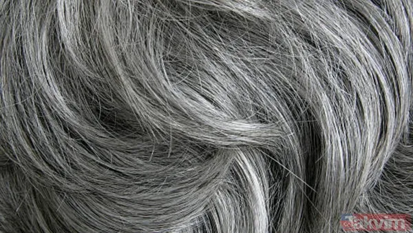 Saçlarınız neden erken beyazlıyor? Genetik mi, stres mi? Cevabı şaşırtacak… - 6