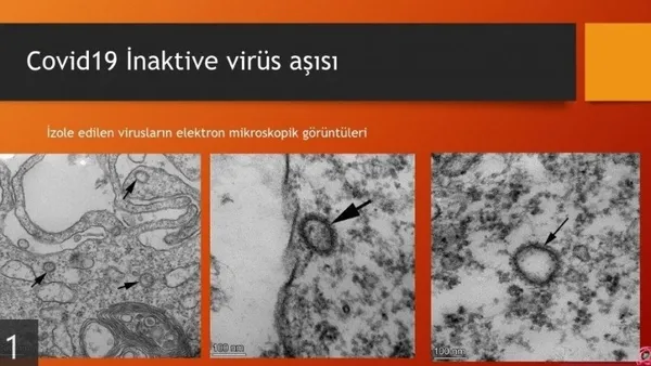 son-dakika-tartisilan-profesor-ercument-ovalidan-yeni-iddia-koronavirus-asisi-bulundu-mu-1587654838586.jpg Son dakika: Tartışılan profesör Ercüment Ovalı'dan yeni iddia! Koronavirüs aşısı bulundu mu?-2