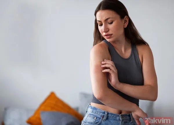 Geçmeyen vücut kaşıntısının sebebi bu olabilir - 4