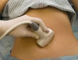 Yumurtalık kistleri tedavi edilebilir