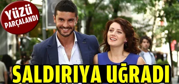 Ünlü oyuncunun yüzü parçalandı