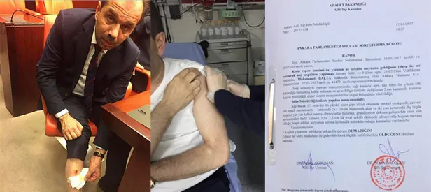 AK Parti'li vekil raporla ısırıldığını ispatladı