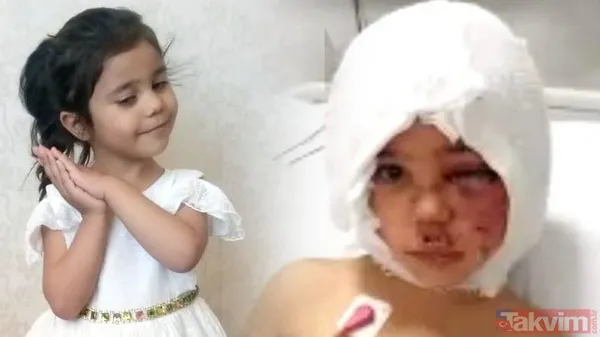 Gaziantep'te ikinci pitbull vakası! Saldırıya uğrayan talihsiz adam konuştu: "Kendimi kurtaramasam parçalayıp öldürürdü" - 10