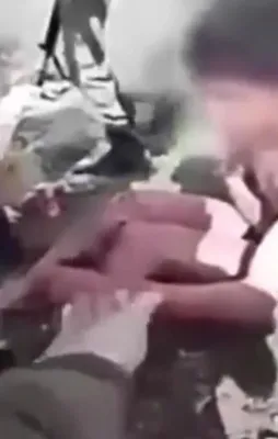 Mehmetçik yaralı teröriste pansuman yaptı
