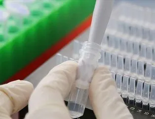 Koronavirüs Çin’de laboratuvarda üretildi