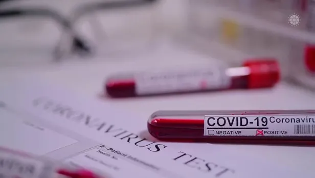 İletişim Başkanı Fahrettin Altun'dan dikkat çeken mesaj: Hiçbir virüs, alacağımız tedbirlerden daha güçlü değildir-2