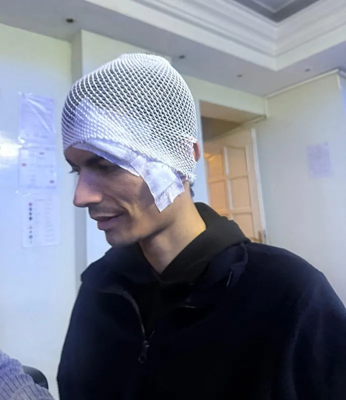 gaziantepte-engelli-bakim-merkezinde-darp-skandali-merkezde-kalan-gencin-kafasina-6-dikis-atildidarp-edilen-en-1766496243823.jpeg Furkan Kaya (İHA)