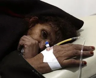 Yemen’de 1 milyon kişi tehlikede