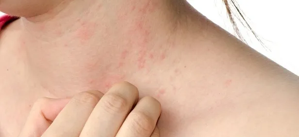 goz-iltihaplanmasinin-anahtari-goz-taramasi-uzmanlar-cocukluktan-itibaren-goz-taramasini-oneriyor-1665618912859.jpeg Göz iltihaplanmasının anahtarı göz taraması! Uzmanlar çocukluktan itibaren göz taramasını öneriyor-5