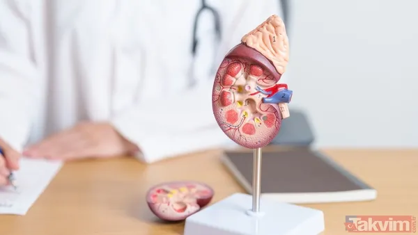 Diyaliz uygulamalarında oruç bozulur mu? Diyanet açıkladı! - 3