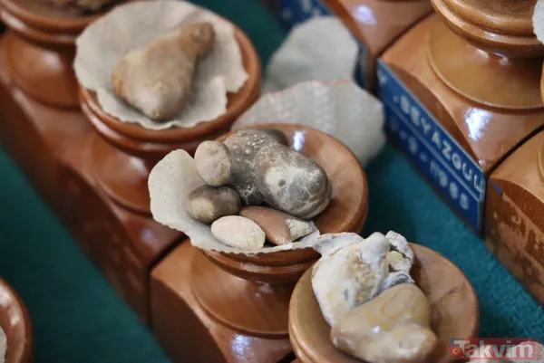 Üroloji doktorundan hayrete düşüren koleksiyon! Taşların kimisi 22 santim kimisi 650 gram - 10