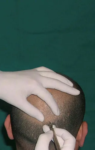 Saç dökülmesi problemi olanlar dikkat! Bu yöntem derdinize çare olabilir