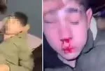 Sağır ve dilsiz çocuğa işkence! Kulağını kesmeye çalıştılar