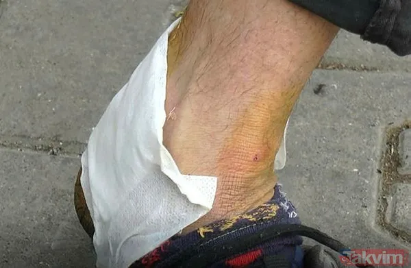 Gaziantep'te ikinci pitbull vakası! Saldırıya uğrayan talihsiz adam konuştu: "Kendimi kurtaramasam parçalayıp öldürürdü" - 3