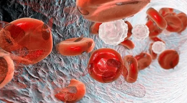 Talasemi hastalığı nedir, belirtileri nelerdir? 8 Mayıs Dünya Talasemi Günü'nde talasemi hastalarına önemli öneriler!-3