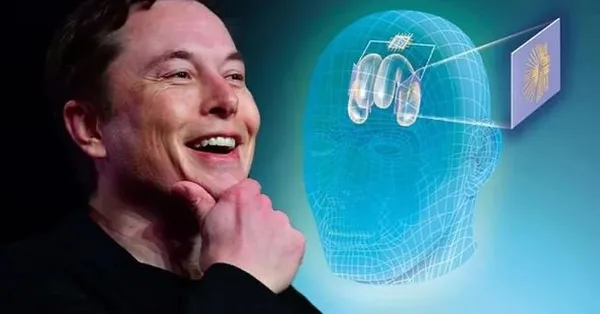 Elon Musk insanlara çip takacak: Neuralink çip tartışma konusu-10
