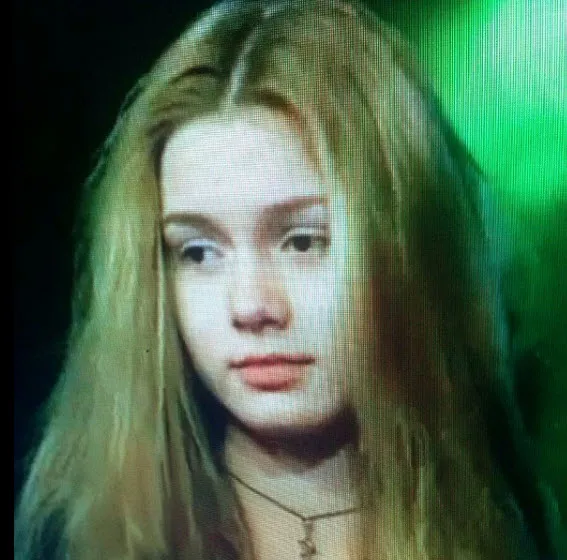 Aleyna Tilki yüzüne ne yaptırdı?-11