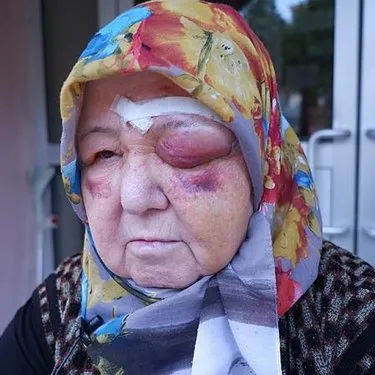 Edirne’de başıboş köpek dehşeti kamerada: Yaşlı kadının yüzü gözü tanınmaz halde