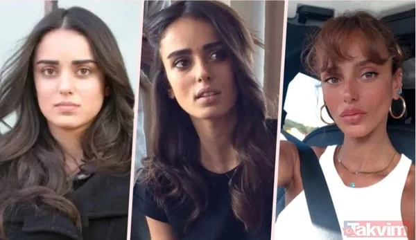 Bestemsu Özdemir estetik açıklamasıyla sosyal medyanın diline düştü! Eski hali olay oldu! “İhtiyaç duymadım...” - 22