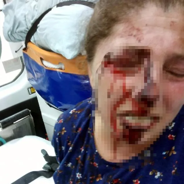 Akrabalar arasında baltalı saldırı!