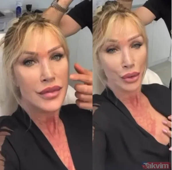 Çağlar Ökten’in biricik eşi Seda Sayan zayıflamakla kalmadı bir de estetik yaptırdı! Göğüs silikonu, Fransız askısı derken son hali... - 18