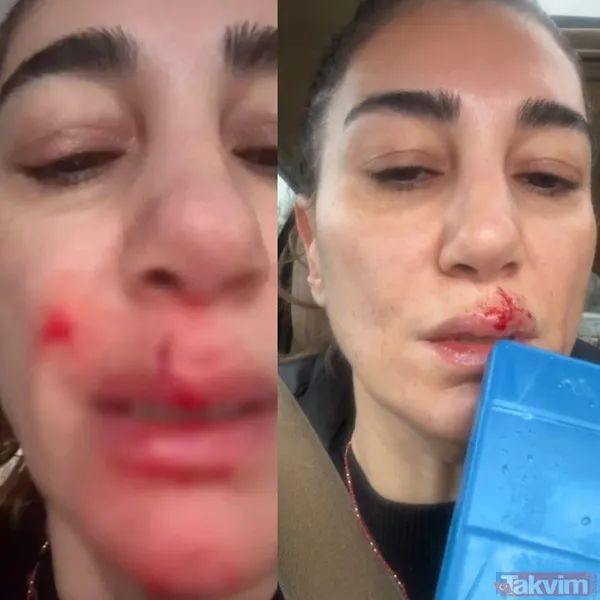 Ünlü Şarkıcının Son Hali Sevenlerini Korkuturken Sosyal Medyada "Geçmiş Olsun" Mesajları Yağdı.