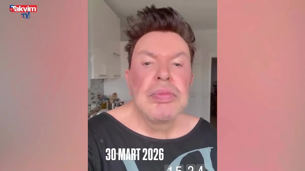 Kuşum Aydın’ın ameliyat sonrası son hali