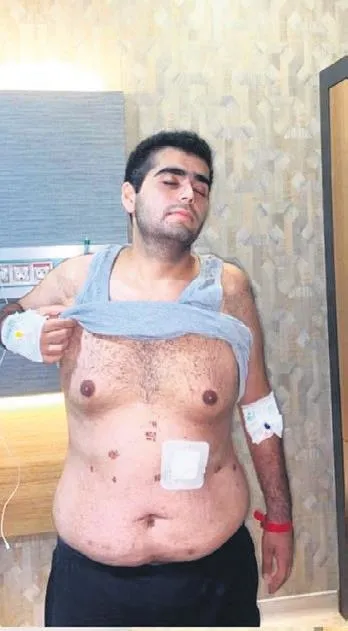 1694984430307.jpeg Umutcan'ın umutları bitti! Askere gitmek için mide küçültme ameliyatı oldu ölümden döndü...-3