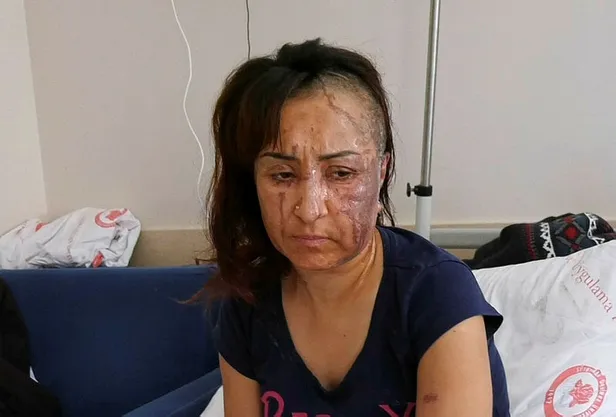 Isparta'da cani adam kendisinden boşanmak isteyen eşine kezzapla saldırdı!-1