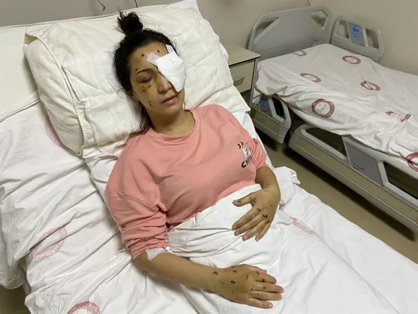 korkunc-olay-agabey-demeyen-yengesinin-gozune-37-kez-bicak-sapladi-1643971772790.jpg Korkunç olay! 'Ağabey' demeyen yengesinin gözüne 37 kez bıçak sapladı-2