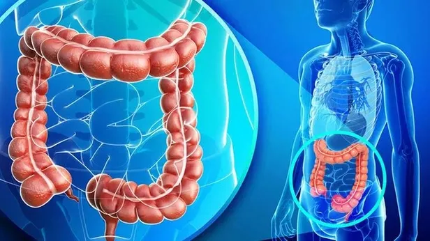 50li-yaslarin-en-buyuk-tehditti-rektum-kanseri-1657141678094.jpeg 50'li yaşların en büyük tehditti rektum kanseri!-3