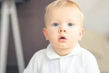 Çocukların yüzde 10’unda besin alerjisine sahip!