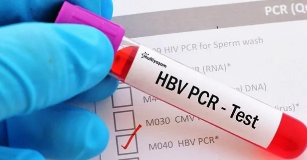 Ameliyat öncesi PCR testi zorunluluğu devam ediyor mu kaldırıldı mı? Ameliyat öncesi PCR testi kalktı mı? Sağlık Bakanlığı son dakika açıklaması...-3