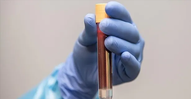 Prostatın düşmanı maydanoz