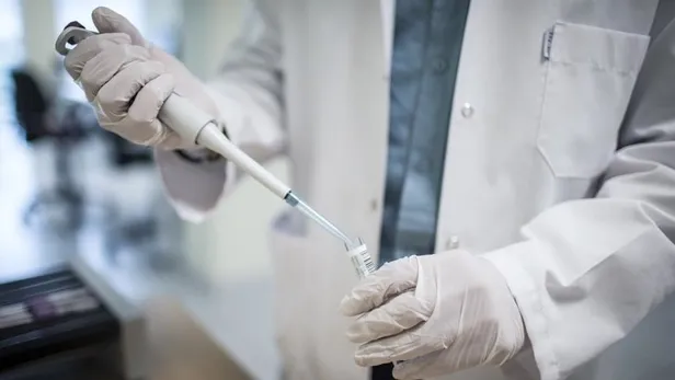 bilim-dunyasinin-yillardir-cozum-aradigi-soruna-turk-bilim-insanlari-cozum-uretti-abdden-destek-geldi-1592822699153.jpg Bilim dünyasının yıllardır çözüm aradığı soruna Türk bilim insanları çözüm üretti! ABD'den destek geldi!-4