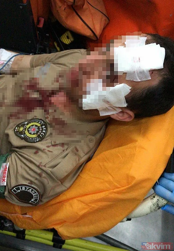 Ağır Yaralı Olarak Hastaneye Kaldırıldı Saldırıda Yaralanan Bekçi Uğur Gölçek, Olay Yerinde Yapılan İlk Müdahalenin Ardından Ambulansla Hastaneye Kaldırıldı.