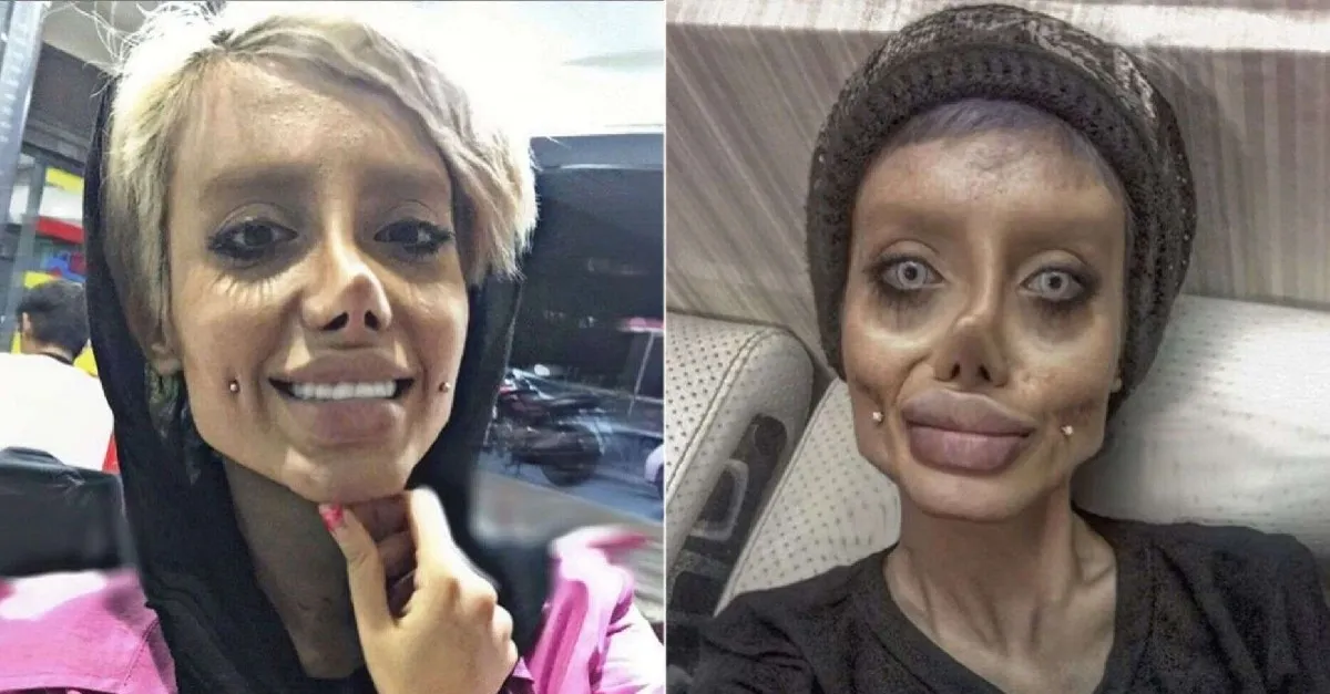 Angelina Jolie’ye benzemek isteyen ’Zombi gelin’ Sahar Tabar corona virüse yakalandı