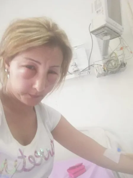 Yalova'da saçlarına boya yaptırmak isteyen kadın canından oluyordu-4