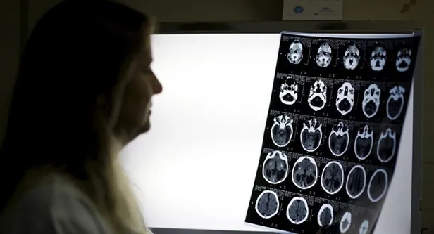 Rusya'da nefes alamayan adam kafasını deldi-1