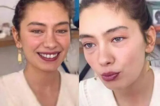 Hastalığı nedeniyle 'Sefirin Kızı' dizisinden ayrılmak zorunda kalmıştı! Neslihan Atagül'ün son hali hayranlarını üzdü