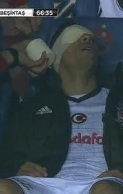 Beşiktaş'ta şok sakatlık